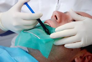 endodoncia duele