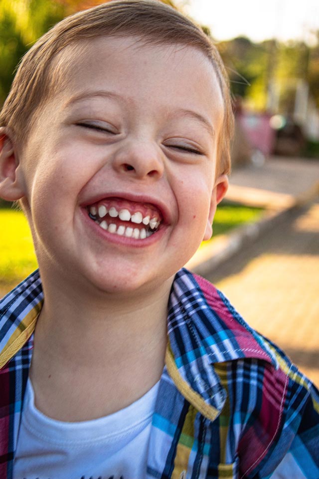 frenectomía labial niños
