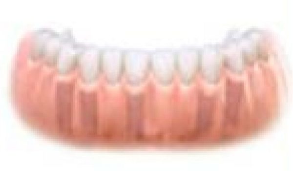 Implantes-paso-4-770x434-1