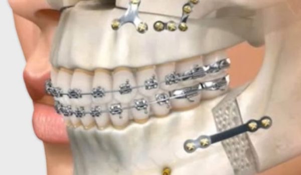 cirugia-maxilofacial-770x434