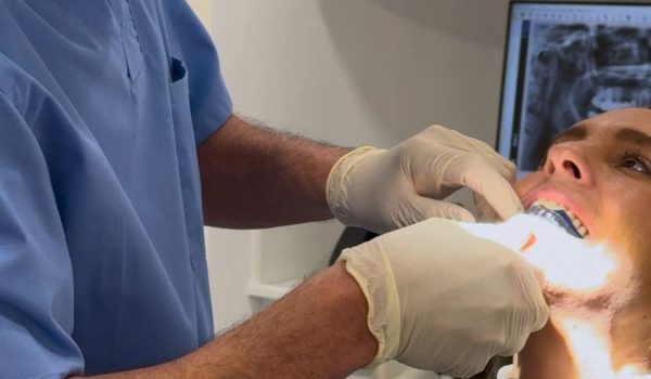 Tratamiento con coronas de disilicato de litio