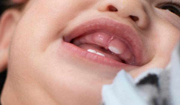 cuidados-dentales-infantiles-770x434
