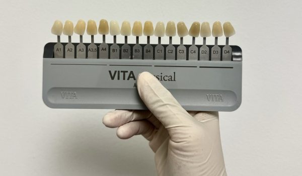 Dientes limados para carillas