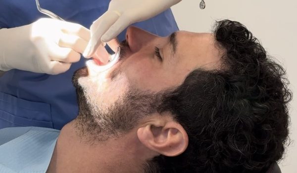 Pericoronaritis en las muelas del juicio