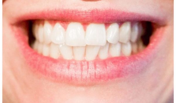 regenerar-esmalte-dental-770x434