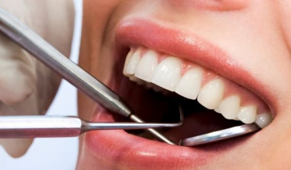 revision-dental-770x434