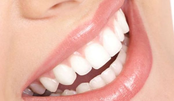 sonrisa-saludable-770x434-1